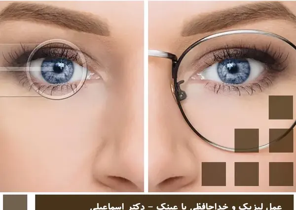عکس از چشم برای لیزیک