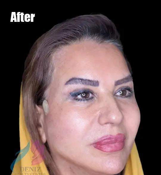 عکس خنده دار عمل زیبایی