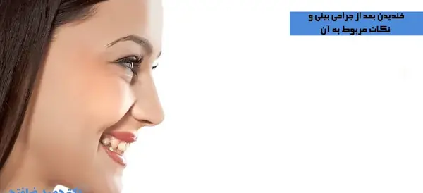 عکس خنده دار عمل زیبایی