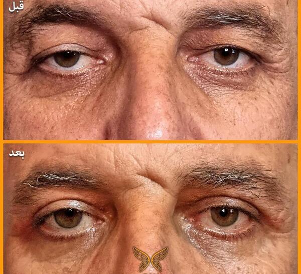 عکس خنده دار عمل زیبایی