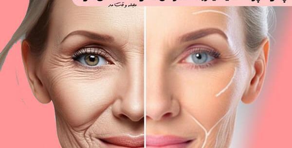 عکس خط خنده لب