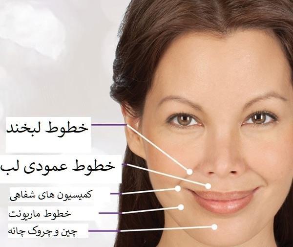 عکس خط خنده لب