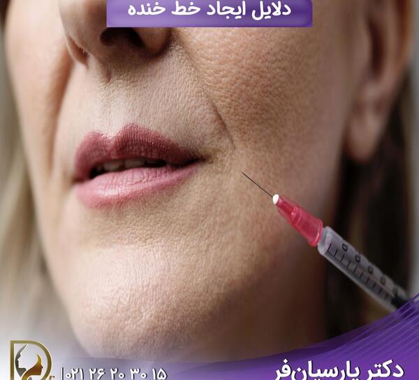 عکس خط خنده لب