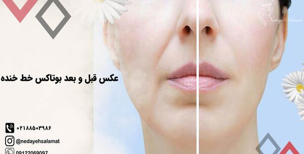 عکس خنده نی نی سایت
