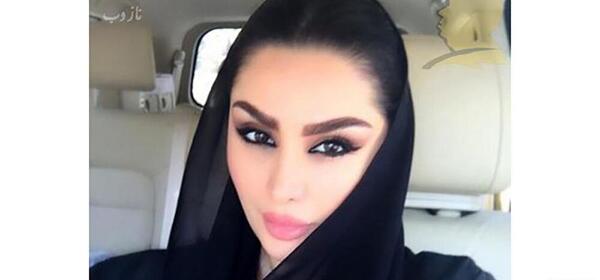 عکس دنیا جهانبخت قبل از عمل