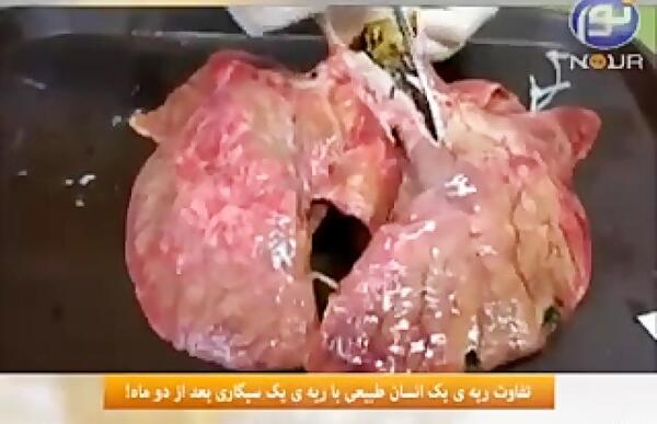 عکس قلب انسان سیگاری واقعی