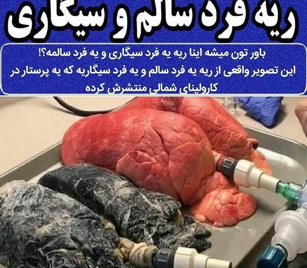 عکس قلب انسان سیگاری واقعی