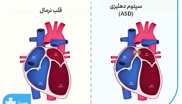 عکس قلب بزرگ شده
