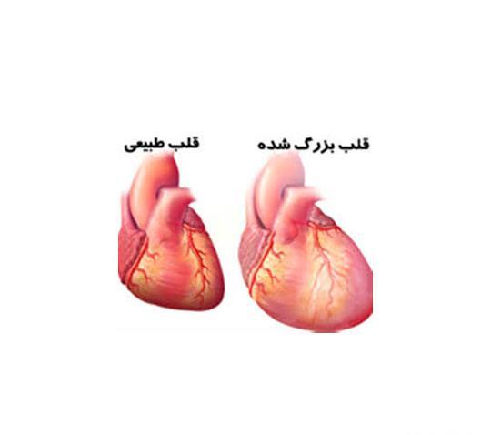 عکس قلب بزرگ شده