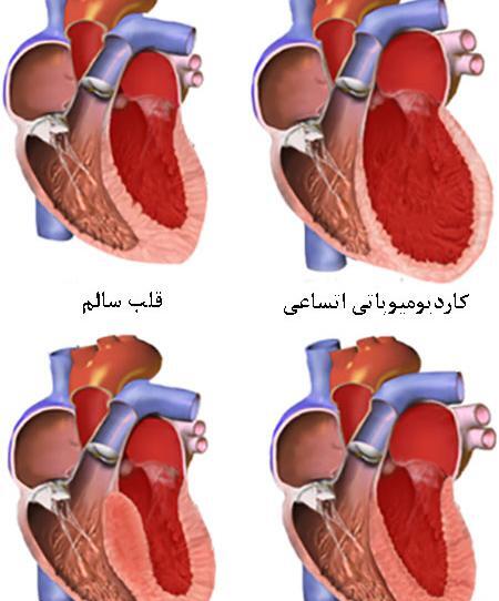 عکس قلب بزرگ شده