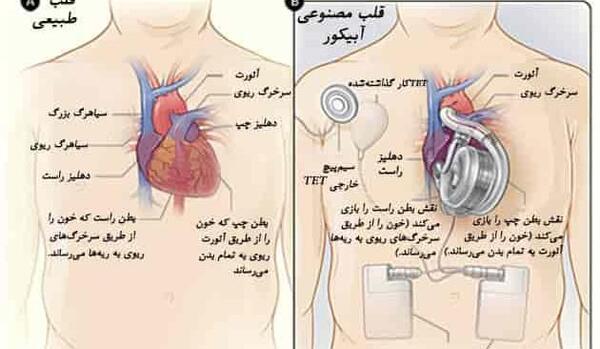 عکس قلب بزرگ شده