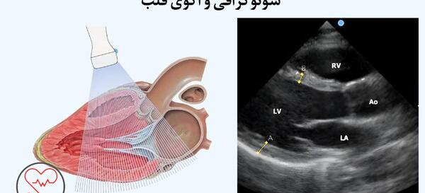 عکس قلب تو بدن