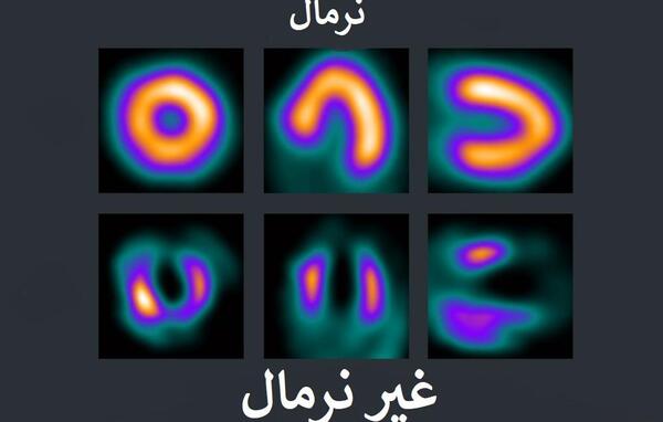 عکس های پزشکی قلب