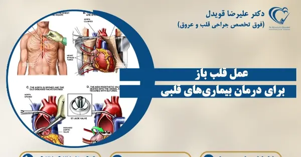 عکس های پزشکی قلب