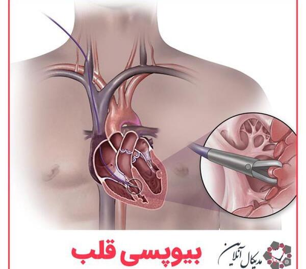 عکس برداری قلب چیست