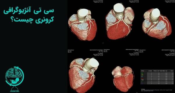 عکس برداری قلب چیست