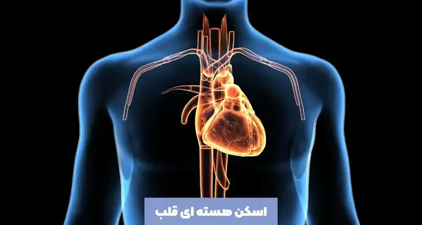 عکس برداری قلب چیست