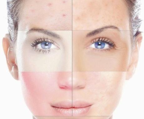 عکس لکه های قهوه ای قارچی روی پوست بدن