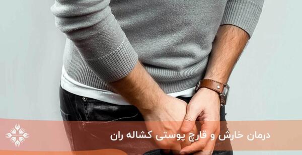 عکس لکه های قهوه ای قارچی روی پوست بدن
