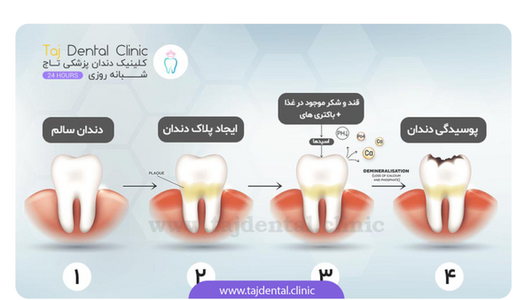 گرفتن عکس دندان در ماه اول بارداری نی نی سایت