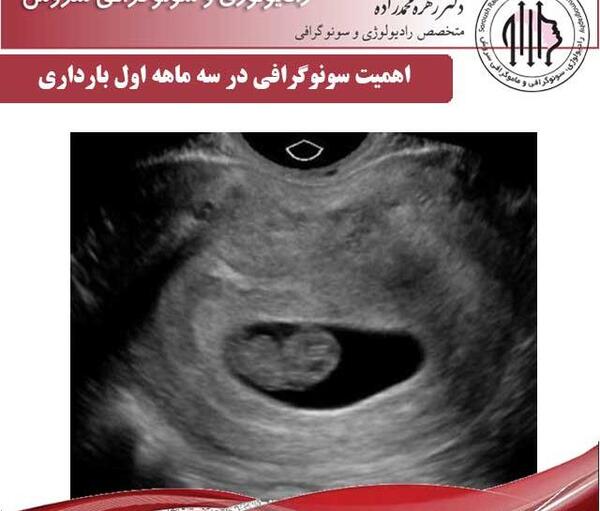 عکس سونو ماه اول بارداری