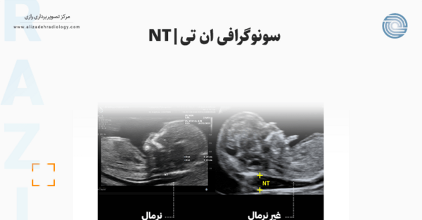 عکس سونو ماه اول بارداری