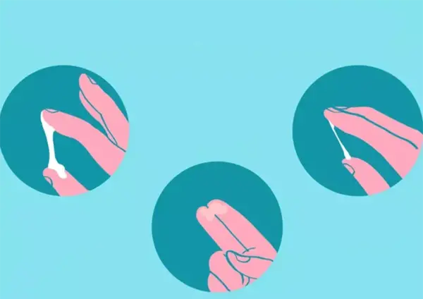 عکس ترشحات ماه اول بارداری