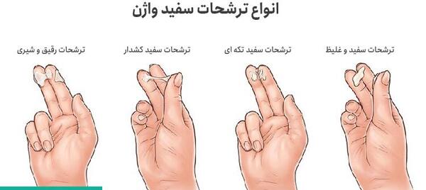 عکس ترشحات ماه اول بارداری