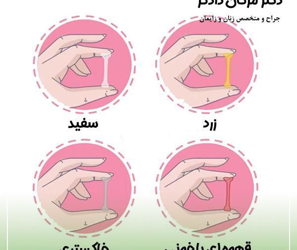 عکس ترشحات ماه اول بارداری