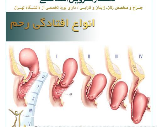 عکس واژن در ماه اخر بارداری