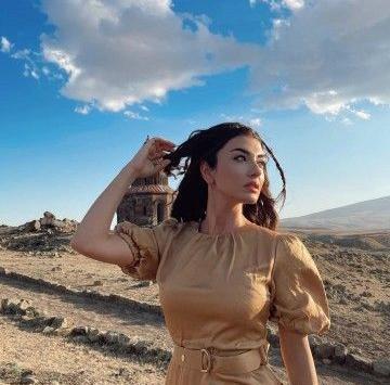 عکس ییلدیز در ستاره شمالی قبل از عمل