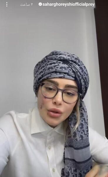 عکس واقعی یلدا در دلنوازان