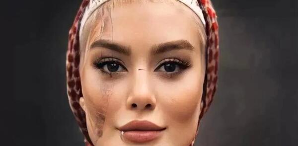 عکس بارداری یلدا در دلنوازان