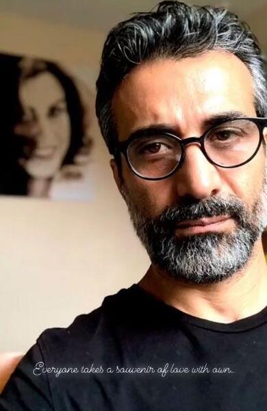 عکس ماه چهره خلیلی قبل از عمل بینی