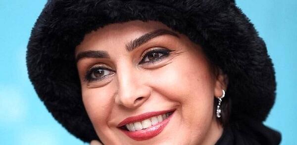 عکس ماه چهره خلیلی قبل از عمل بینی