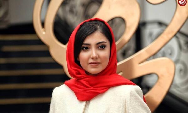 عکس های زیبا کرمعلی قبل از عمل زیبایی