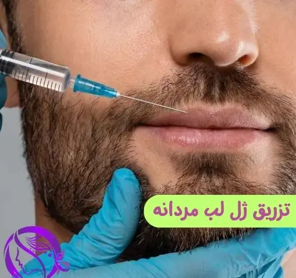 عکس ژل لب مردانه