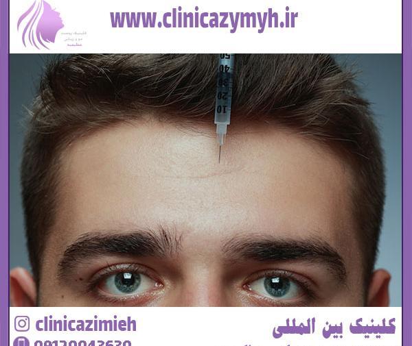 عکس ژل لب مردانه