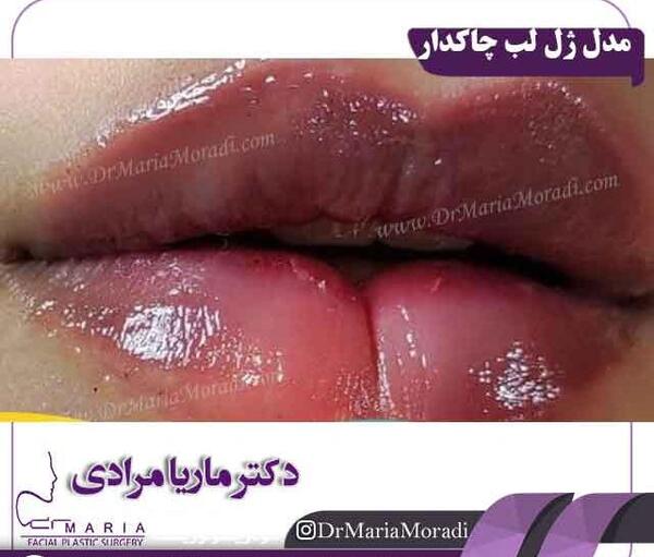 عکس ژل لب مردانه