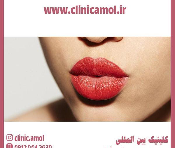 عکس ژل لب مردانه