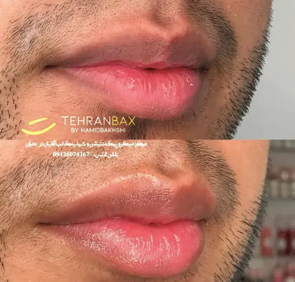عکس ژل لب مردانه