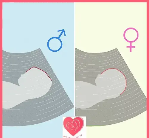 عکس جنین پسر و دختر در سونوگرافی