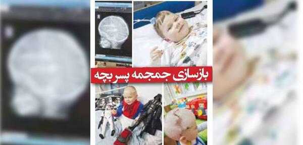 عکس جمجمه جنین پسر و دختر