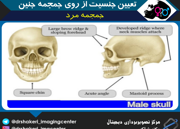 عکس جمجمه جنین پسر و دختر