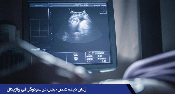 عکس جنین پسر 12 هفته
