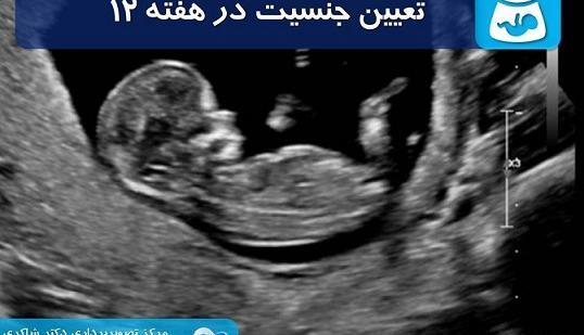 عکس جنین پسر در 12 هفته