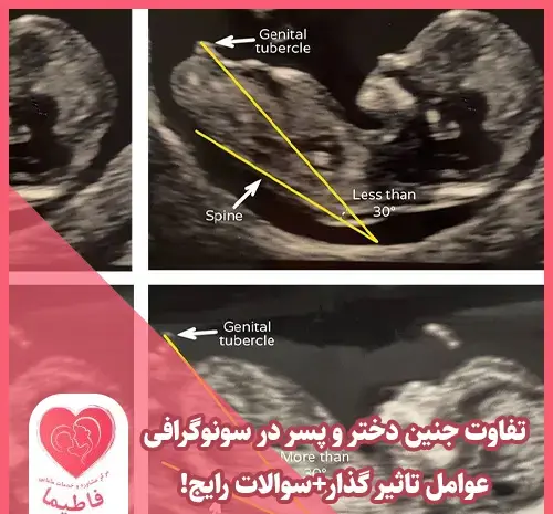 عکس جنین پسر در هفته 17 بارداری