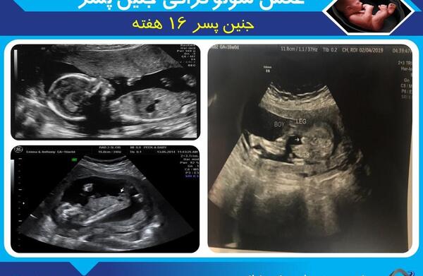 عکس جنین پسر در هفته 16