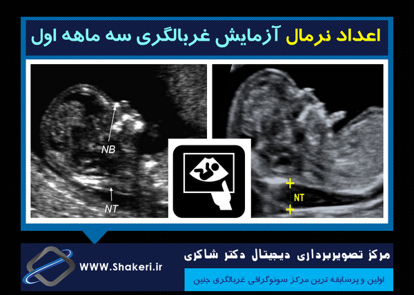 عکس سونوگرافی nt جنین پسر نی نی سایت