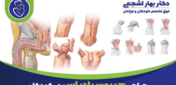عکس اندام تناسلی جنین پسر نی نی سایت